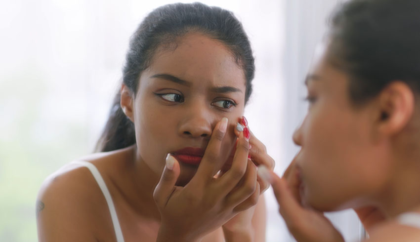 How To Get Rid Of Blackheads: Ultimate Guide